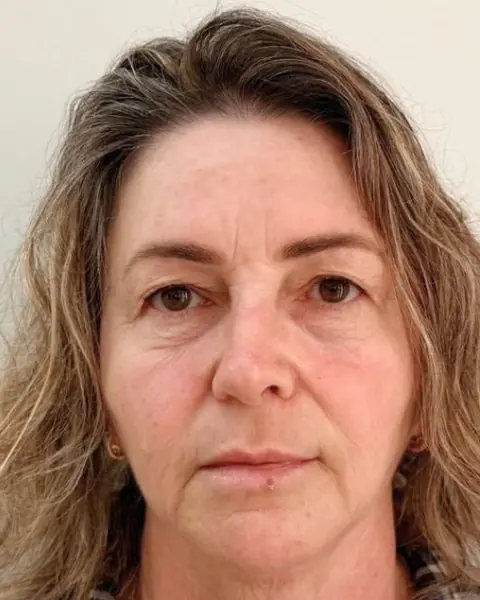 Antes: rosto de frente com linhas e menos contorno